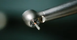 Dentista em Florianópolis indeniza paciente após perda de broca cirúrgica Dentista em Florianópolis indeniza paciente após perda de broca cirúrgica