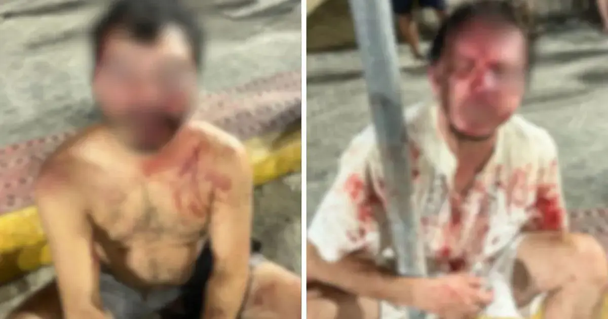 Dois homens feridos e ensanguentados estão sentados no chão, com marcas de agressão visíveis em seus corpos.