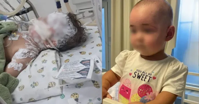 Criança em hospital, com curativos e tubos ligados, ao lado de outra criança sentada em cadeira alta.