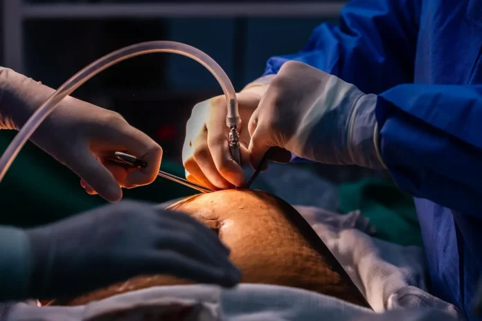 Mãos com luvas realizando cirurgia, usando instrumentos cirúrgicos e tubos em um paciente em uma mesa de operação.